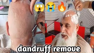 How to get rid old man head dandruff by razor shaved  Ali salon work [upl. by Ahsienod704]