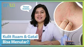 Kulit Gatal Kering amp Ruam di Lipatan Tubuh Ketiak Leher Kaki Ini Cara Mengatasinya dari Dokter [upl. by Maxim564]