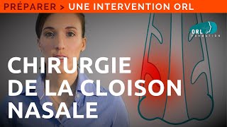 Chirurgie de la cloison du nez septoplastie  Information Patient ORL [upl. by Lytsirhc]