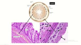 Figure of Enteric Nervous System Plexuses in histology slide of gut [upl. by Norabal]