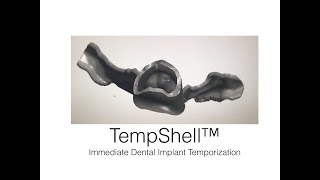 TempShell Immediate Implant Temporization Technique [upl. by Kotick]