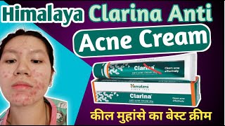 Himalaya Clarina Anti Acne Cream कील मुहांसे को जड़ से खत्म करे। 100 आयुर्वेदिक पिंपल मुहासा क्रीम [upl. by Anikat]