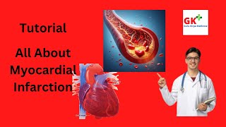 Myocardial Infarction Etiology Pathophysiology Symptom and Treatment [upl. by Camel]