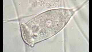 Vorticella sp in activated sludge [upl. by Yuht]