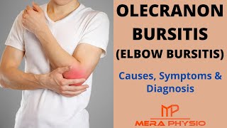 Olecranon Bursitis Elbow Bursitis  Causes Symptoms amp Diagnosis  In Hindi  Mera Physio [upl. by Ilac]