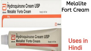 Melalite Forte Cream uses side effects and doses in Hindi [upl. by Vierno]