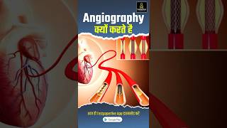 What is Angiography in Hindi angiography radiographerexam testpaperliveparamedicalclasses [upl. by Hewet]