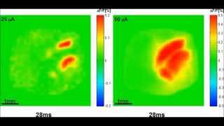 In Vivo VoltageSensitive Dye Study of Lateral Spreading of Cortical Activity in Mouse Primary [upl. by Attehcnoc]