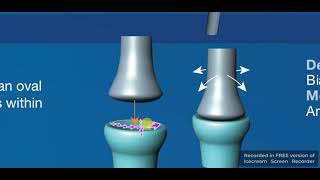 Condyloid amp Ellipsoid synovial joints [upl. by Eeb]