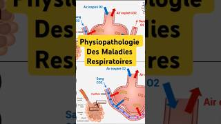 Physiopathologie Maladies Respiratoires pneumologie bronchite asthme fibrosepulmonaire poumon [upl. by Emmeline]