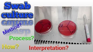 Swab culture test procedure Microbiology [upl. by Ojadnama270]