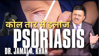 Psoriasis Causes Triggers and Treatments  Dr Jamal A Khan [upl. by Lledniw]