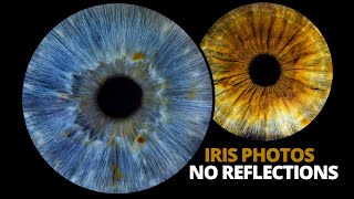 Professional eye photography tutorial  Iris photos with no reflections [upl. by Dubois3]