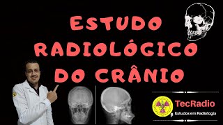 ESTUDO RADIOLÓGICO DO CRÂNIO [upl. by Jacinda901]