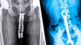 20 Strangest Things Discovered by XRays [upl. by Morez]