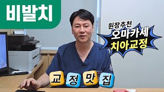 비발치 치아교정 치아교정 교정치료 소아교정 [upl. by Tsirhc81]