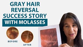 Gray Hair Reversal Success Story  Proof  With Blackstrap Molasses [upl. by Lairret]