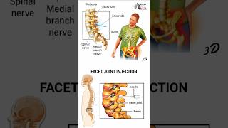 US Spine Facet Procedure  medical animation 3d short  BiologywithAliya [upl. by Millur30]