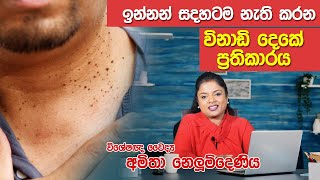 කරදරකාරී ඉන්නන් ඉවත්කරන නිවරදිම ක්‍රම  Warts Removal  Skin Specialist [upl. by Aelegna254]