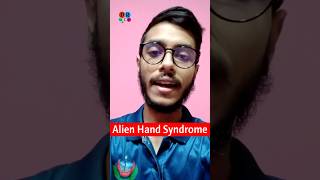 Alien hand syndrome  Alzheimers disease  Brain tumor  Dr Med  Sakib Rahaman [upl. by Cleveland]