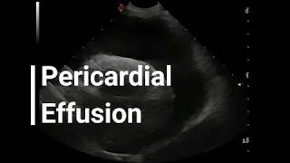 Vet Emergency Ultrasound Draining a Pericardial Effusion [upl. by Gabey]