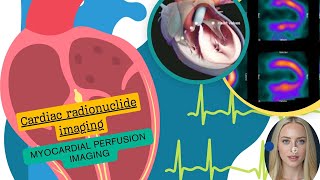 Cardiac radionuclideimaging [upl. by Mikeb]