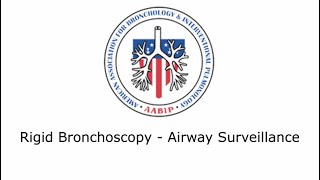 Rigid Bronchoscopy Airway Surveillance [upl. by Ylek]