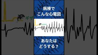 病棟でこんな心電図あなたはどあする？part2 心電図検定 看護師 [upl. by Moore]