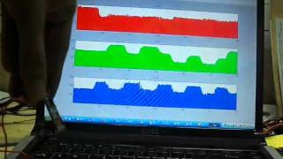 Accelerometer analog output in MATLAB [upl. by Aidnyc]