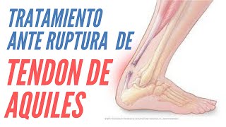 Tratamiento ante RUPTURA de tendon de Aquiles  parte 2 [upl. by Wurster207]