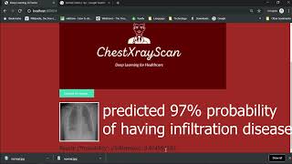 Lung Disease Prediction from Chest X Rays [upl. by Veal]