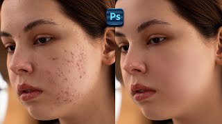 Skin Retouching in Photoshop  Tutorial For Beginners [upl. by Enrico454]