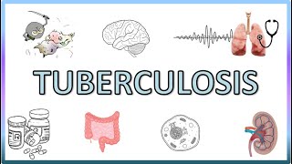 Tuberculosis  Types Pathogenesis Signs and Symptoms Diagnosis Treatment and Prevention [upl. by Casimir]