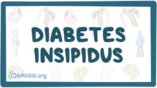 Diabetes insipidus  causes symptoms diagnosis treatment pathology [upl. by Oniram]