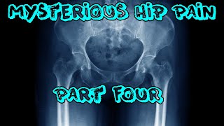 Mysterious Hip Pain  Part 4 [upl. by Tekla]