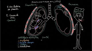 Pneumothorax  Docteur Synapse [upl. by Isidore]