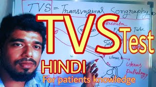 TVS Sonography in Hindi  Transvaginal ultrasonography  Ultrasound [upl. by Soren266]