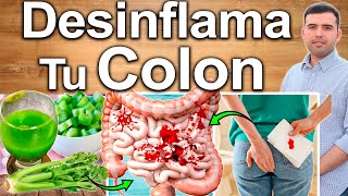 Cómo Desinflamar El Colon  Elimina La Colitis En 3 Pasos [upl. by Acirret905]