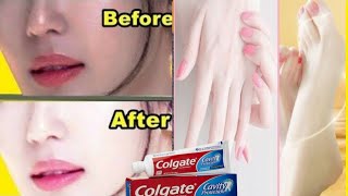 COLGATE TOOTHPASTE FOR FACE WHITENING  LEMON AND COLGATE [upl. by Nair]