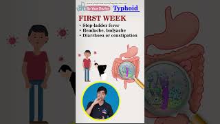 Typhoid causes  Typhoid symptoms  Typhoid treatment  Typhoid short [upl. by Younger]