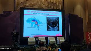 Screening fetal brain anatomy Qingqing wu [upl. by Dlaniger]