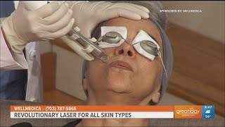 The ULTRACLEAR Laser rejuvenates all skin types [upl. by Namajneb]