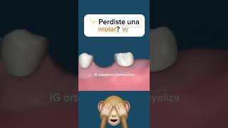 Molar uprighting orthodontictips ортодонтия kieferorthopädie विषमदंत ortodonzia orthodontie [upl. by Stutzman]