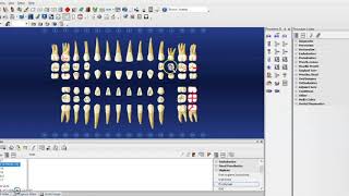 Hard Tissue Charting on Dentrix [upl. by Wilek315]