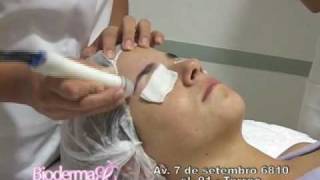 Peeling de Cristal  Bioderma [upl. by Atims]