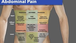 abdominal examination  فحص البطن [upl. by Sualokcin]