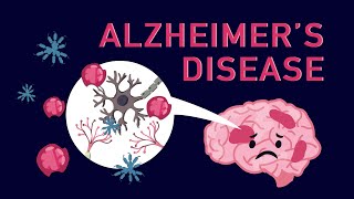 What is Alzheimer’s Disease [upl. by Amedeo514]