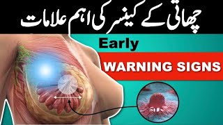 BREAST CANCER SYMPTOMS IN URDU drtayyibaaj [upl. by Nyral934]