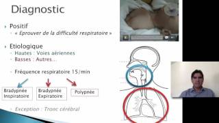 Dyspnée Dysphagie Dysphonie DFGSM2 [upl. by Alodie]