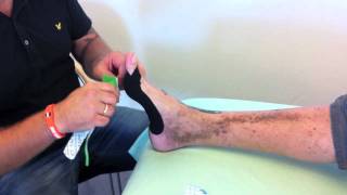 Kinesio tape for Hallux Valgus [upl. by Malilliw]